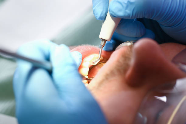 Best Same-Day Emergency Dentist in Salem, AR