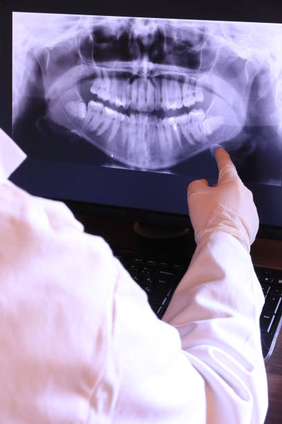 Best Emergency Tooth Extraction in Salem, AR