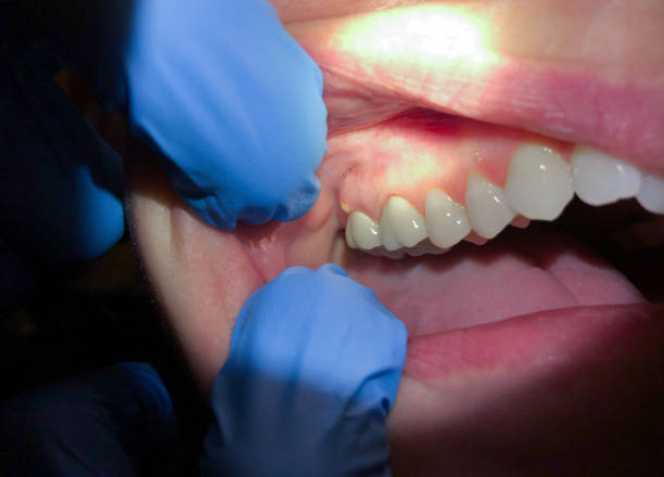 Best Emergency Dental Surgery in Salem, AR